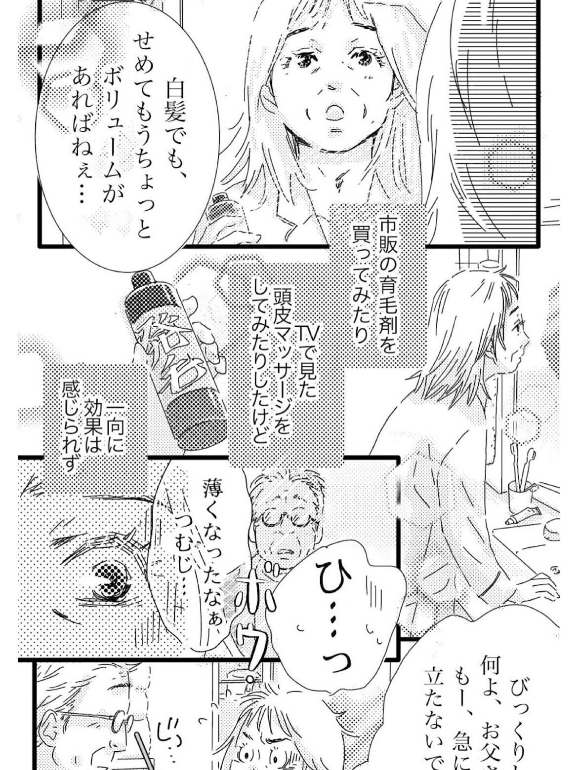 【抜け毛が多く以前より髪が薄くなったとお悩みのあなたへ】