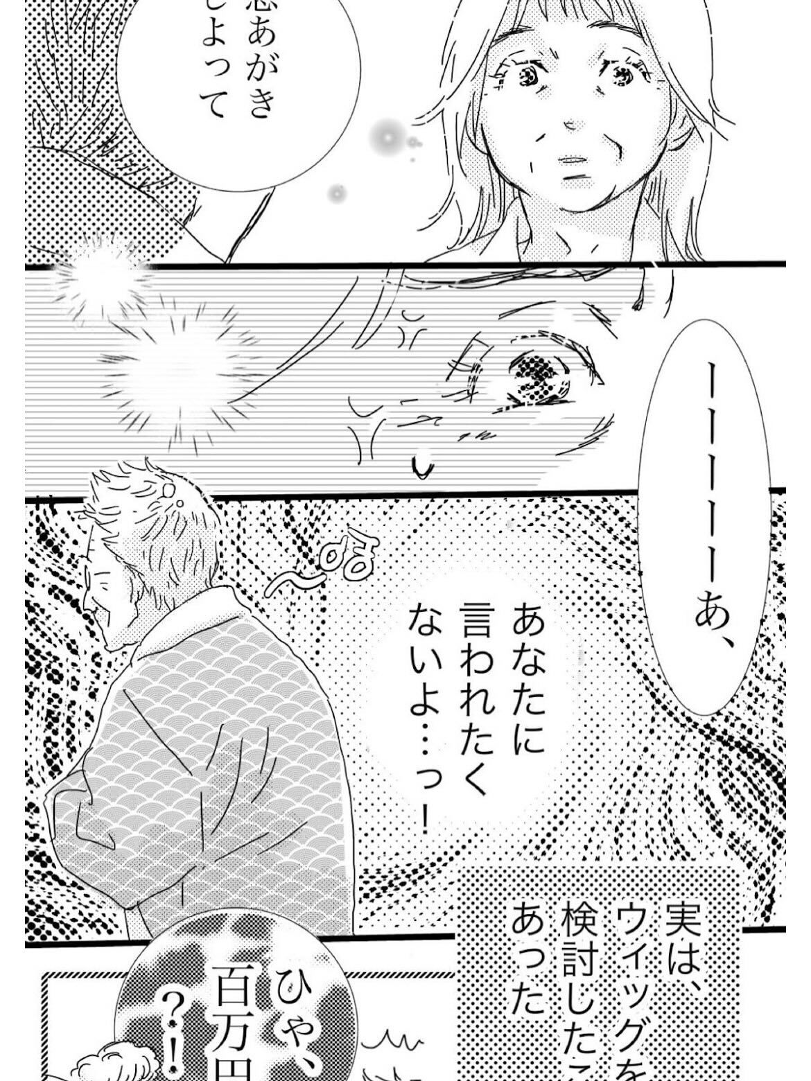 【抜け毛が多く以前より髪が薄くなったとお悩みのあなたへ】